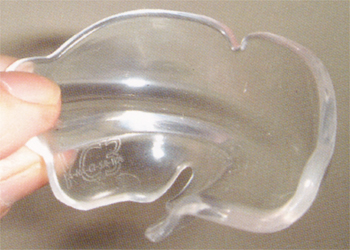 反対咬合治療器ムーシールド|渡辺歯科