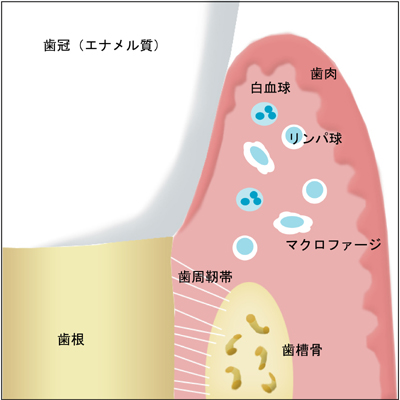 口腔内の免疫機能 歯周治療について|渡辺歯科